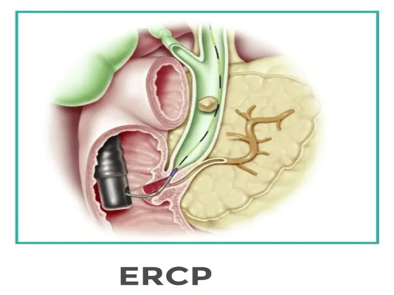 تجهیزات ERCP