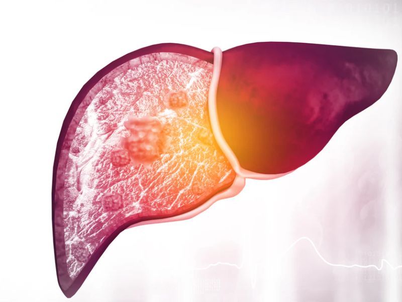 پاکسازی کبد