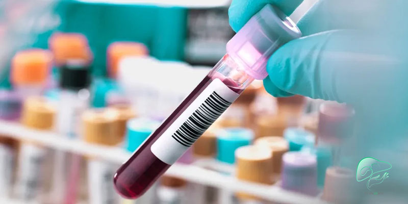 علائم-غلظت-خون