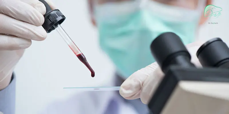 علت-غلظت-خون-چیست؟