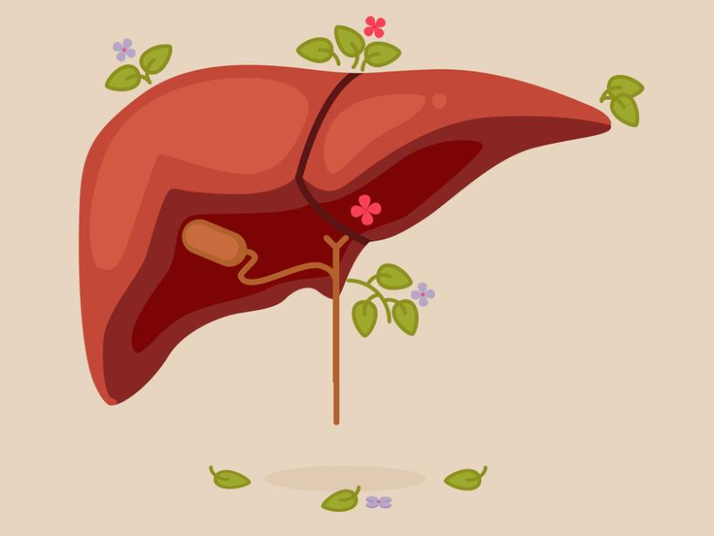 درمان کبد چرب