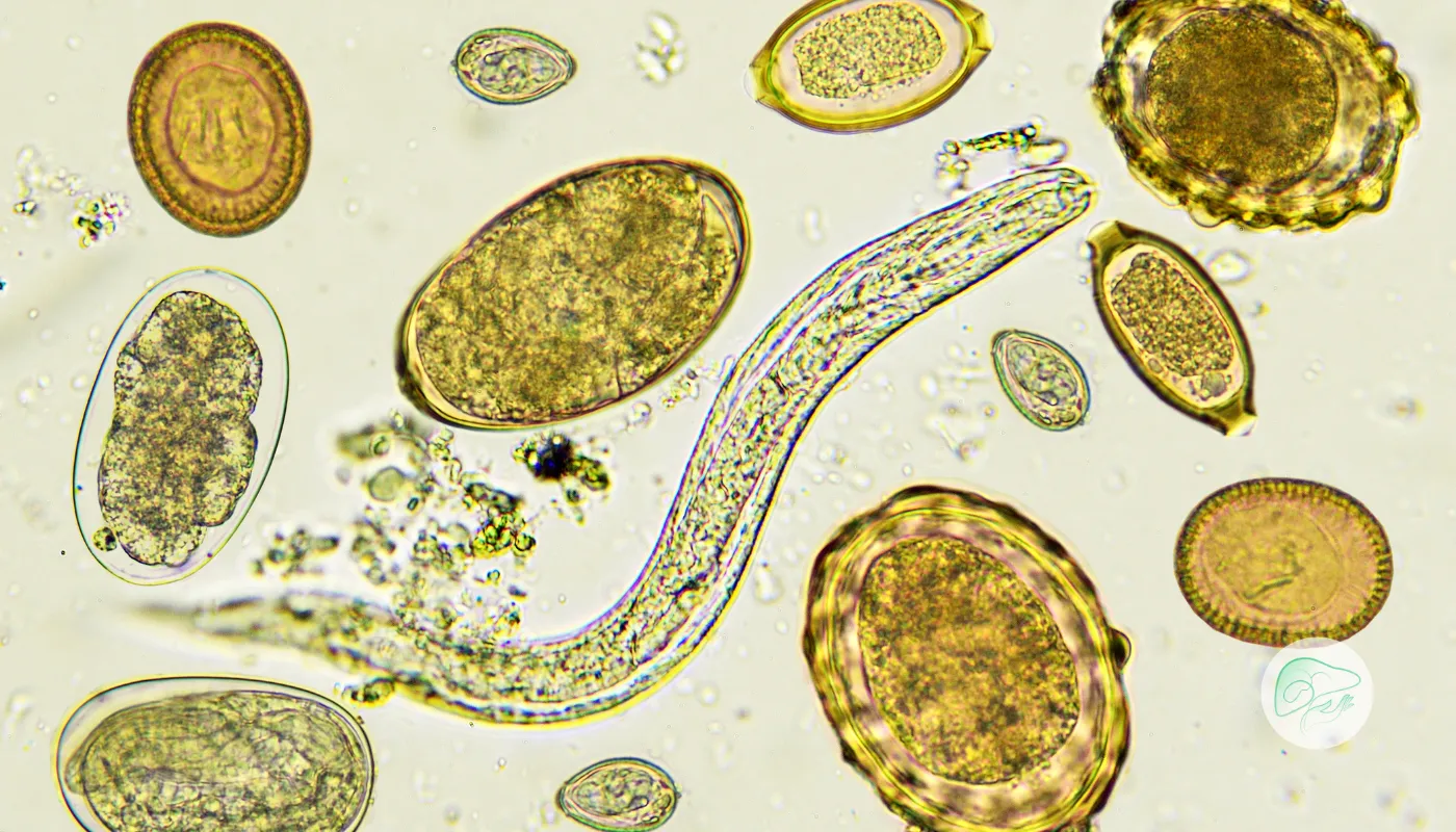 کیست هیداتید چگونه ایجاد می‌شود؟