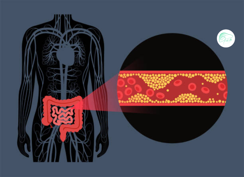 مدیریت درد ایسکمی مزانتر