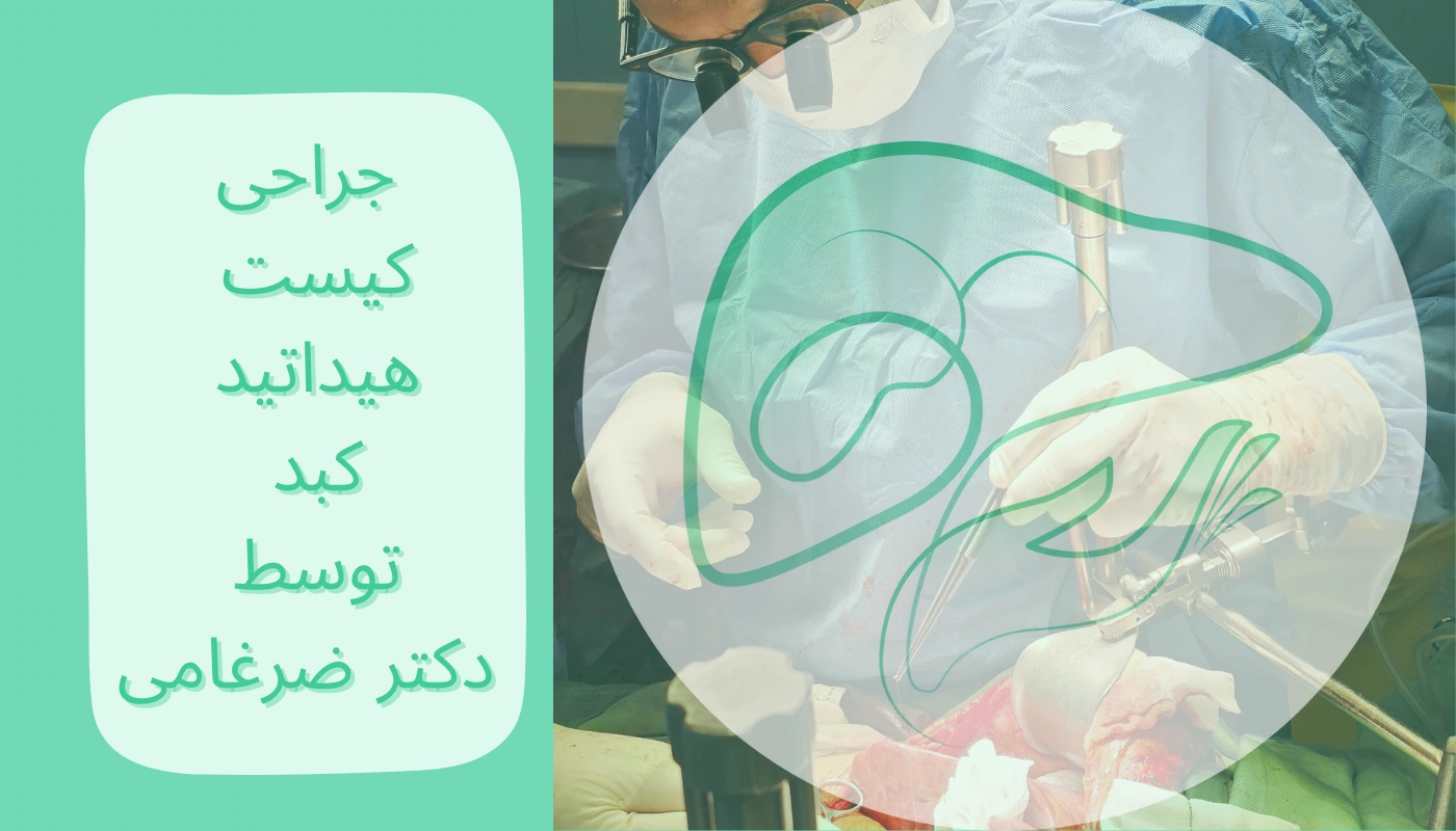 راه‌های درمان این بیماری چیست؟