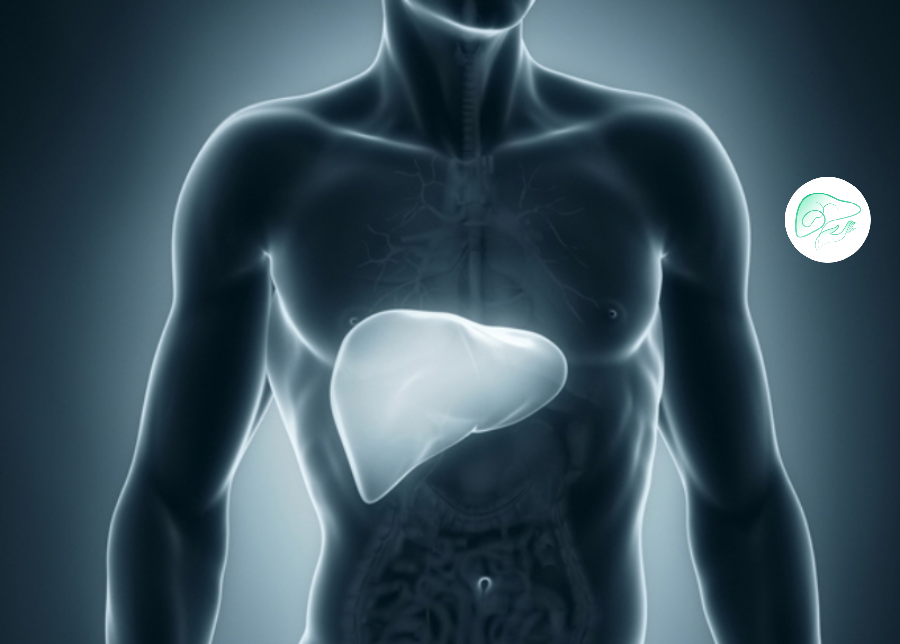 انواع تومورخوشخیم کبد