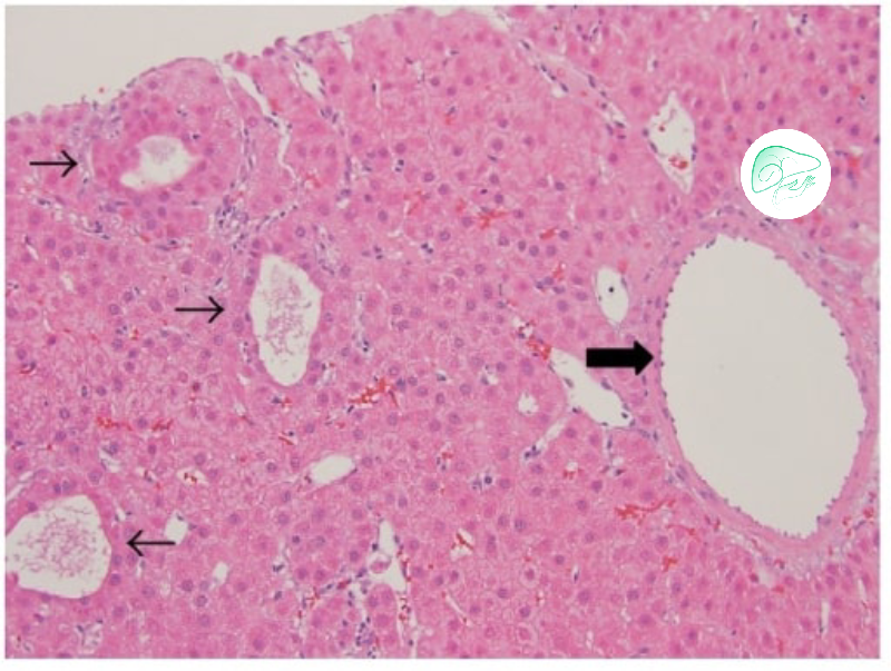 زمان مراجعه به پزشک برای درمان