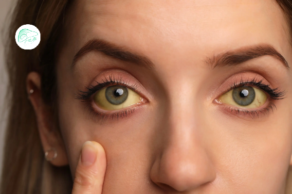 علائم رد شدن پیوند کبد