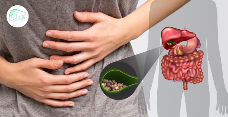 سنگ کیسه صفرا و همه چیز در مورد آن