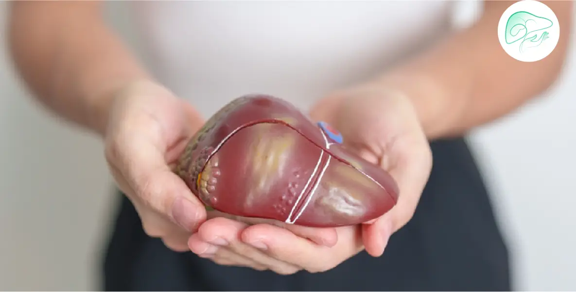 لیست انتظار پیوند کبد در تهران