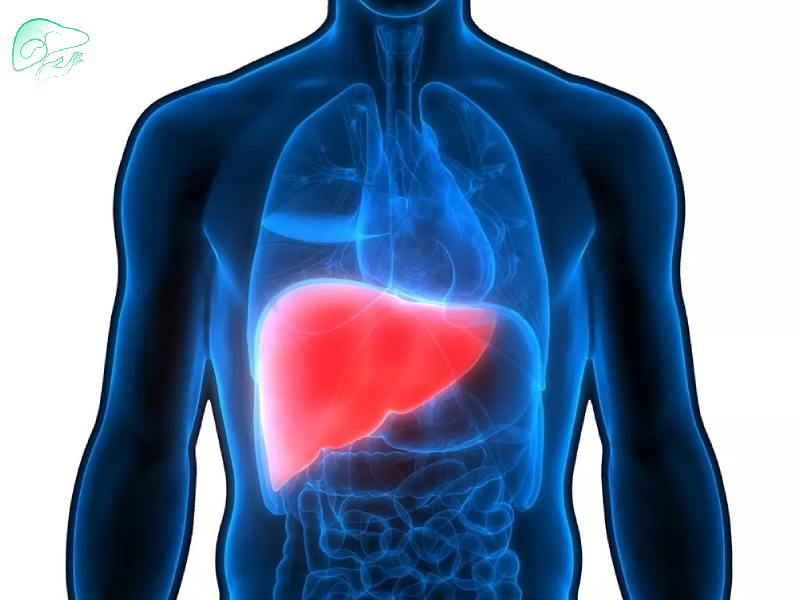 تاثیر فعالیت بدنی بر کبد چرب