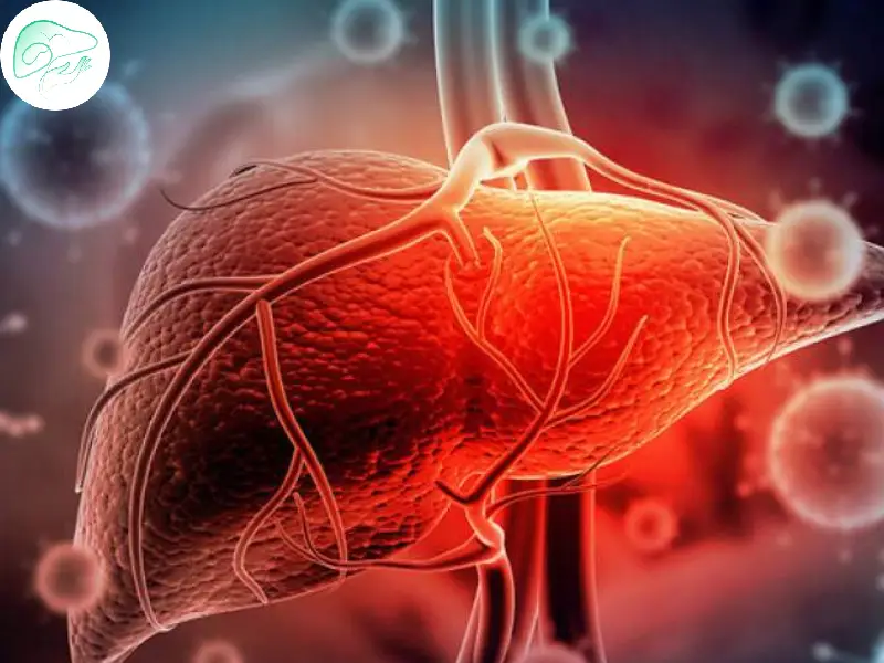 فیبروز کبدی
