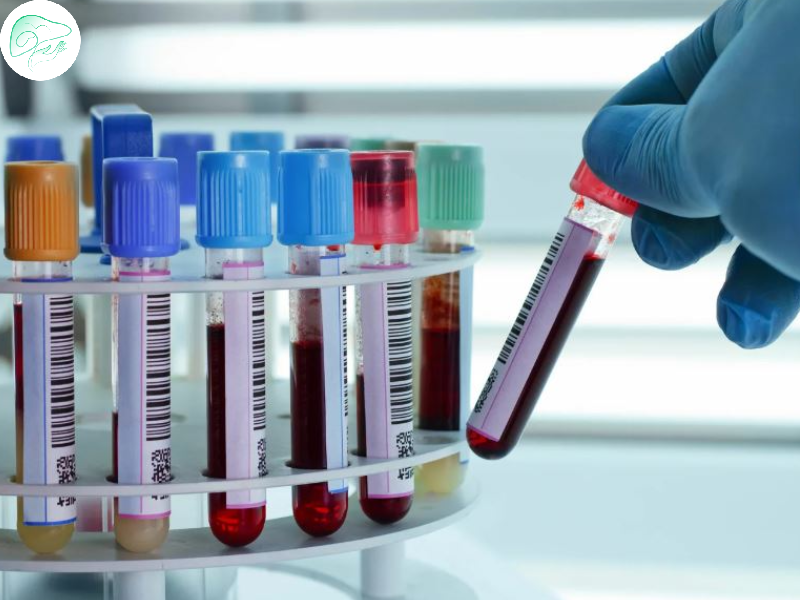 آزمایشات پیوند کبد