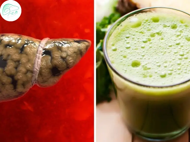 راهکارهای طبیعی برای سم‌زدایی کبد؛ چگونه کبد خود را پاکسازی کنیم؟