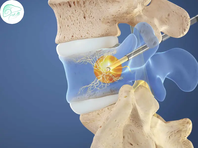 اهمیت تشخیص و کنترل غلظت خون