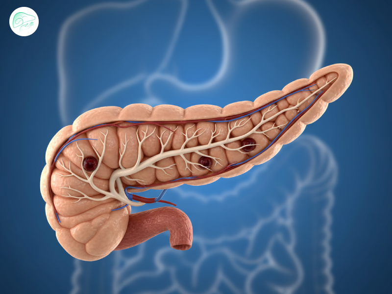 علائم هشداردهنده مشکلات پانکراس