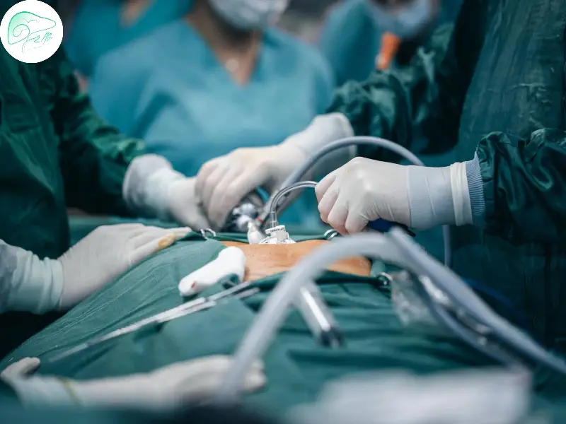 مراحل جراحی لاپاراسکوپی