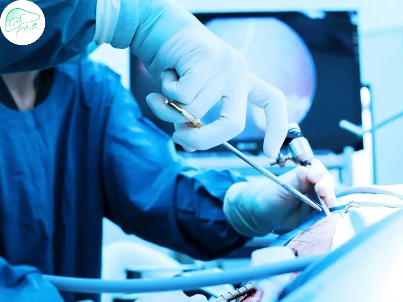 مزایای جراحی لاپاراسکوپی